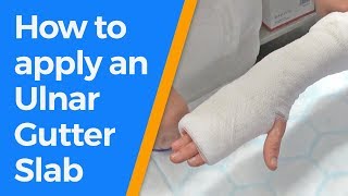 How to apply an Ulnar Gutter Slab [upl. by Korwin37]