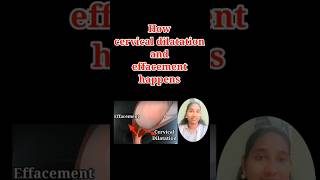 How cervical dilatation and effacement happens trending viraltelugu nursing foundation channel [upl. by Buckels]