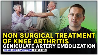 GENICULAR ARTERY EMBOLIZATION  Nonsurgical treatment of knee arthritis  Dr Gaurav Gangwani [upl. by Kos608]