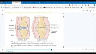 4346 CONCEPTS OF CARE FOR PTS WITH ARTHRITIS AND TOTAL JOINT ARTHROPLASTY PART 1 [upl. by Jeffie]