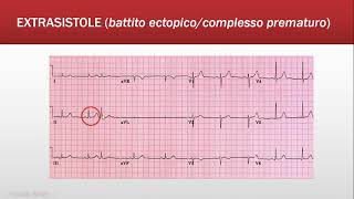 ECG Base Ritmo  Quiz FOAMed [upl. by Gib]