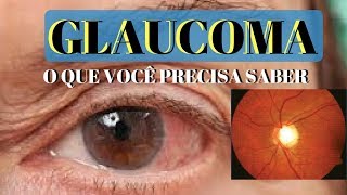 GLAUCOMA o que é e quais os seus sintomas  Dr André Wambier [upl. by Sanford]