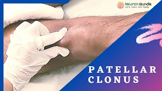 Patellar Clonus ReflexTest sustained Positive Medschool uppermotorneuron neurology [upl. by Akemrehs]