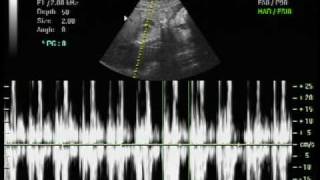 Our 3d4d ultrasound at 28 weeks and Babys Heartbeat at 28 weeks [upl. by Stempien702]