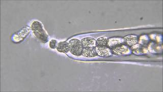 Oomycota Zoospore Discharge [upl. by Yelich]