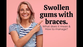 Swollen Gums With Braces What Does It Mean [upl. by Ruffo]