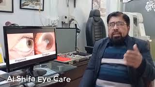 What Is Difference Between Pterygium and Pinguecula Causes and Treatment  Urdu Hindi [upl. by Erkan]