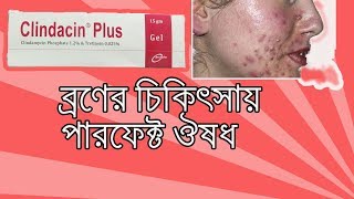 Clindacin Plus Gel  what is clindamycin gel used to treat Bangla [upl. by Wrennie]