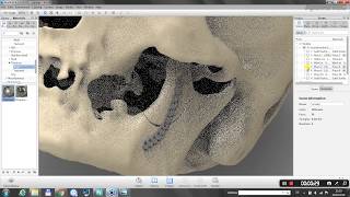 Custom Made Craniofacial Surgical Planning with Geomagic Freeform [upl. by Ause]