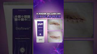 O poder de cura do Oxyflower [upl. by Daukas]