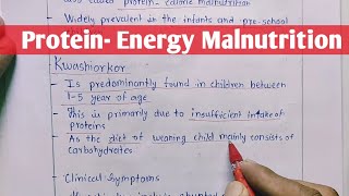 Protein  Energy Malnutrition  Kwashiorkor  Marasmus  Biochemistry [upl. by Ellah]