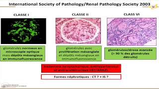 Néphropathies lupiques  Quelle prise en charge 2 [upl. by Anneiv]