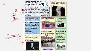 Osteogenesis Imperfecta CBL [upl. by Adyeren771]