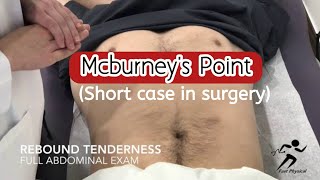 Mcburneys point । Appendicitis । Surgery short case । MBBS Final prof [upl. by Greggs]