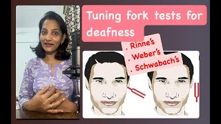 Tuning fork tests for deafness I Clinical physiology I First MBBS I Auditory nerve examination [upl. by Helaina]