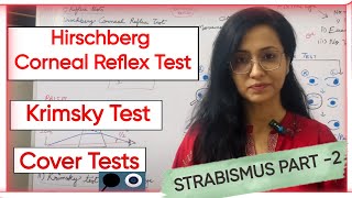 Strabismus Part 2  Hirschberg Corneal Reflex Test  Krimsky Test  Cover Tests [upl. by Mya]