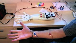 Roujin Project  InMoov Arm and EMG 1 [upl. by Calendre]