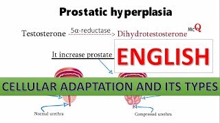 Cellular Adaptation with Histological slide in English [upl. by Stanhope478]