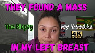 They Found A Mass In My Left Breast  My Biopsy  The Results  Biopsy Mammogram BreastHealth [upl. by Jagir745]