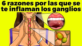 6 RAZONES POR LAS QUE SE TE INFLAMAN LOS GANGLIOS [upl. by Ced246]