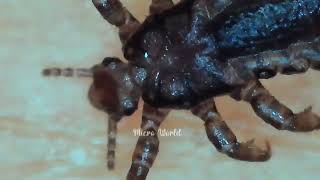 Lice details in tamil  பேன் பற்றிய குறிப்பு [upl. by Yssirhc]