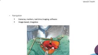 Acetabular Malpositioning by Dr William Pianta [upl. by Eirrek]