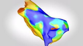 Cardiac Interventions Guys and St Thomas NHS Foundation Trust amp King’s College London [upl. by Ola]