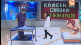 Doctor TV Todo sobre el cáncer de cuello uterino 010813 [upl. by Asela184]