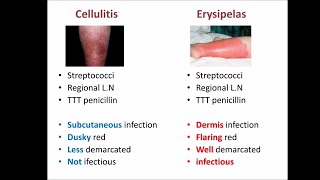 cellulitis vs erysipelas [upl. by Gussy383]