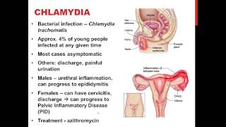 Chapter 27 SEXUALLY TRANSMITTED INFECTIONS [upl. by Dearden389]