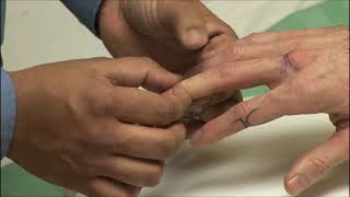 Hand Examination  OSCE Guide old version  UKMLA  CPSA [upl. by Hayifas]