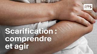 Scarification chez les adolescents  comprendre et prendre en charge  RTS [upl. by Komsa]