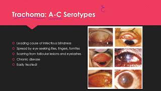 Trachoma [upl. by Volotta]