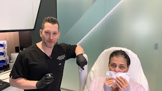 Female Facial Sculpting with Belotero  Smokers Lines and Lip Rejuvenation  West Hollywood CA [upl. by Lucretia340]