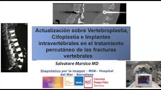 672 Actualización sobre Vertebroplastia Cifoplastia e Implantes intravertébrales [upl. by Truscott]