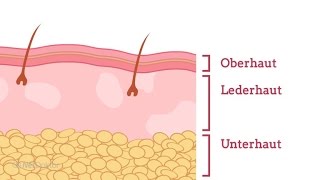 Wie entsteht Neurodermitis  NetDoktorde [upl. by Yticilef]