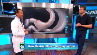 Doctors TV Weight Loss Sleeve Gastrectomy by Dr Feiz  Part 3 [upl. by Etirugram]