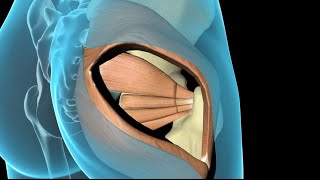 Total Hip Replacement [upl. by Sualokin]