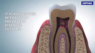 What is oral biofilm [upl. by Solhcin110]