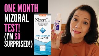 HAIR LOSS SUFFERER REVIEWS NIZORAL SHAMPOO One Month Review On 2 Ketoconazole IM VERY SURPRISED [upl. by Dyl419]