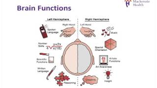 Stroke Education  Causes and Effects [upl. by Gadmon]