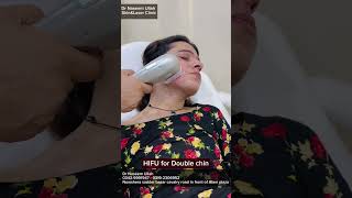 Hifu treatment by Dr Naseemullah dermatologist [upl. by Eenalem552]