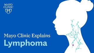 Mayo Clinic Explains Lymphoma [upl. by Ael]