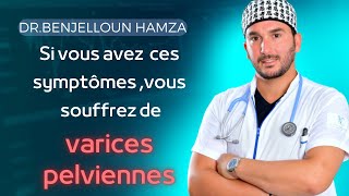 Si vous avez ces symptômes vous souffrez de varices pelviennes [upl. by Aicemat]