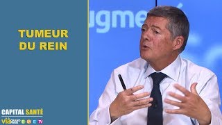 Tumeur du rein  une biopsie est elle nécessaire   2 minutes pour comprendre [upl. by Ihp895]