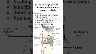 Signs and symptoms of knee meniscus and ligament injuries [upl. by Suehtomit]