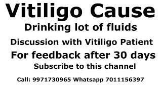 Vitiligo Cause  Patient Discussion [upl. by Leahcimnoj]