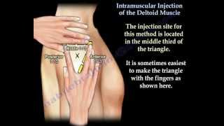 Deltoid Intramuscular injection  Everything You Need To Know  Dr Nabil Ebraheim [upl. by Aivul]