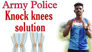 knock knee problem solution  knock knees  knock knee army exercise knock knee  mahesh awhale [upl. by Yemac572]