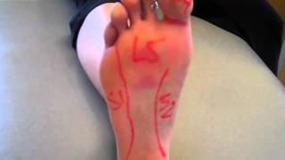 Dealing with Neuropathy in Feet Causes Symptoms and Treatments [upl. by Dhiman]